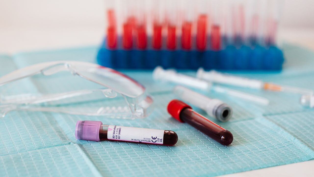 blood test