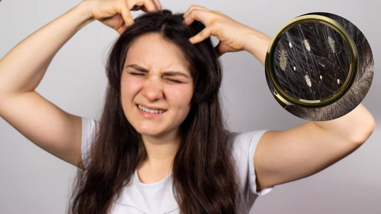 पावसाच्या पाण्यात भिजून केसांमध्ये उवा झालेत? 'हे' घरगुती उपाय लगेच देतील आराम