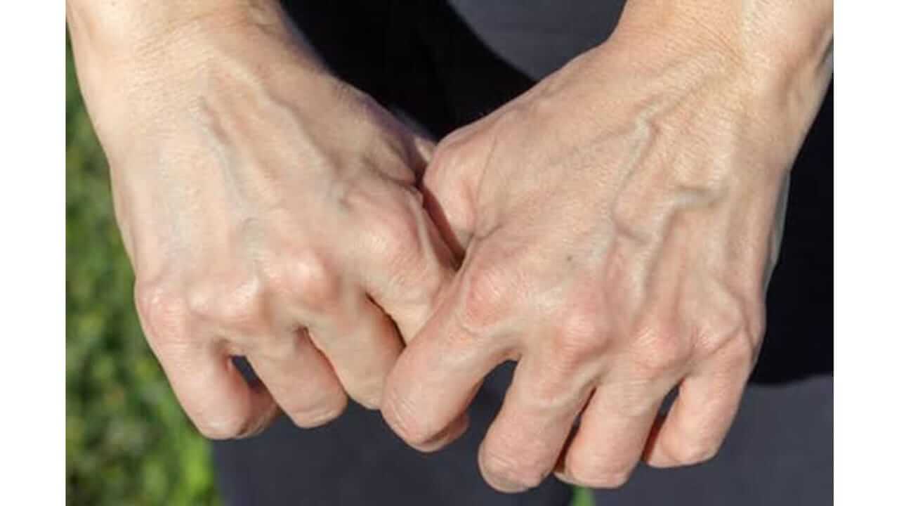 रक्ताचा रंग लाल, मग नसा निळ्या-हिरव्या रंगाच्या का दिसतात? जाणून घ्या...