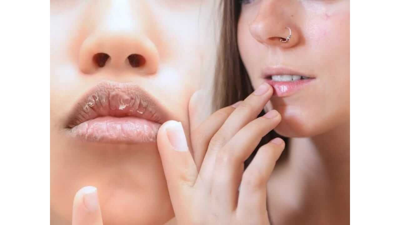 पावसाळ्यात तुमचे ओठ कोरडे पडत आहेत का? 'या' सोप्या टिप्स फॉलो करा